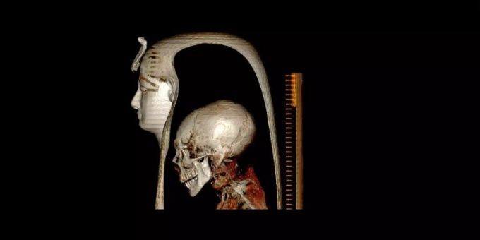 3D-Rekonstruktion von Amenophis I. Mumie