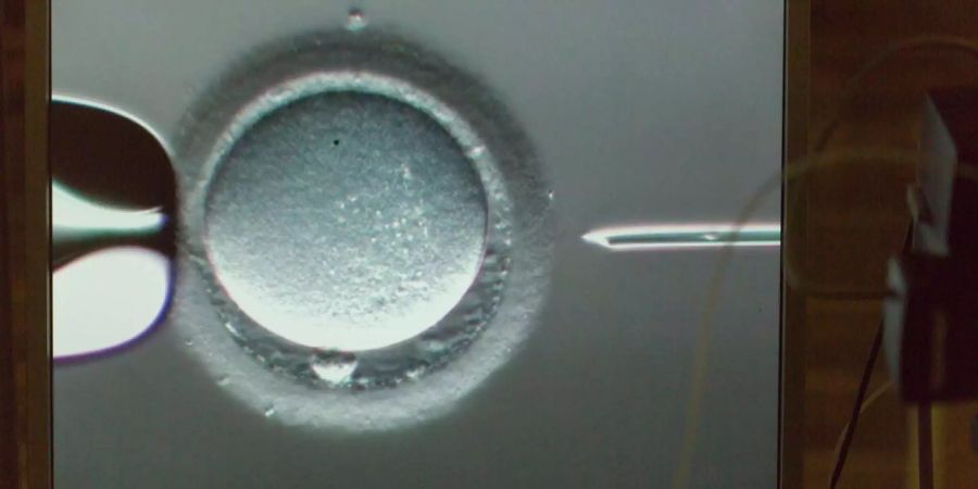 Mikroskopaufnahme einer Injektion eines Spermiums in eine Eizelle (ICSI: Intra Cytoplasmic Sperm Injection), an der Abteilung für Reproduktionsmedizin des Inselspital Bern.