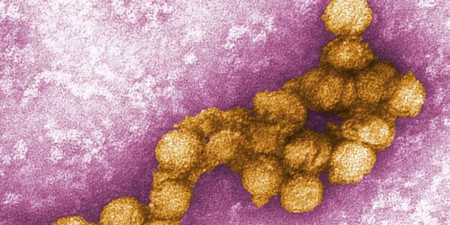 Das Foto zeigt eine elektronenmikroskopische Aufnahme des West-Nil-Virus.