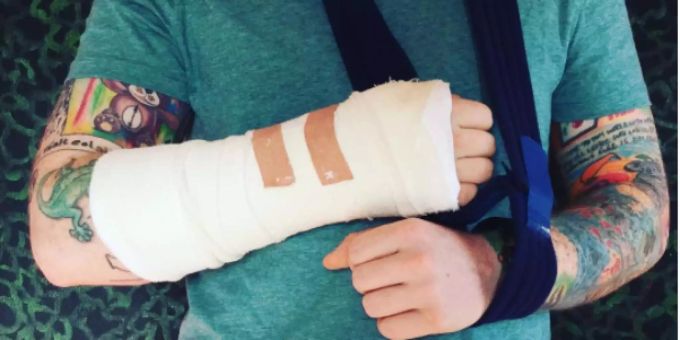 Werden Konzerte abgesagt? - Ed Sheeran bricht sich bei Fahrradfahrt den Arm