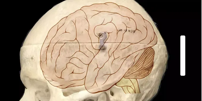 Forscher Entschlusseln Ursache Von Menschlichem Hirnwachstum