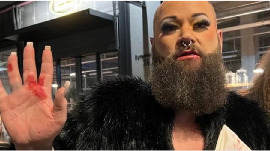 Die Thuner Dragqueen «Miss Miss Chris» wurde kürzlich bei einer Attacke in Zürich verletzt.