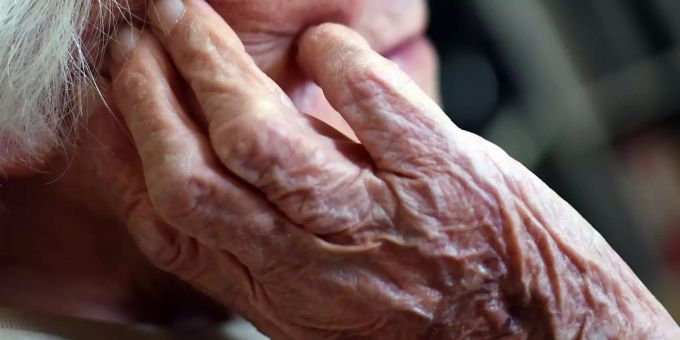 Eine Demenz-Patientin hält ihre Hand an den Kopf. (Symbolbild) Demenz Risiko