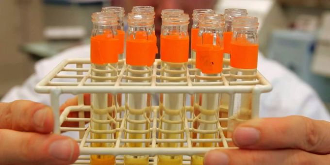 Affäre ausgeweitet - Russische Spione hatten Doping-Experten im Visier