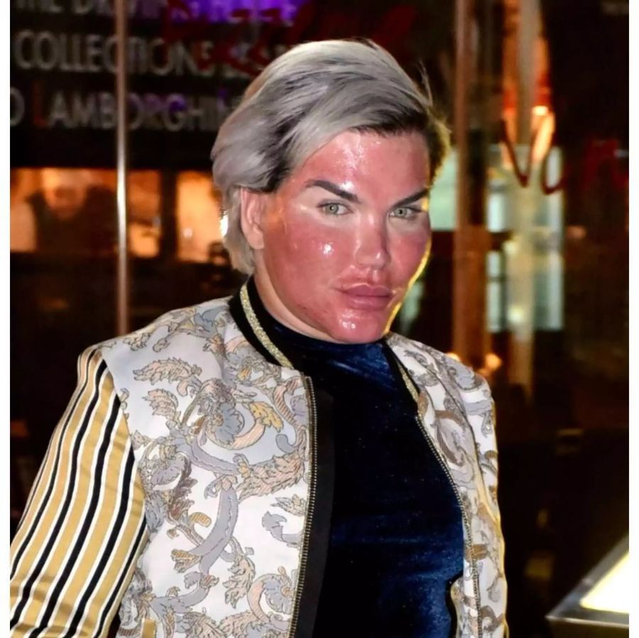 Autsch! Human Ken Rodrigo Alves klagt nach einem Chemie-Peeling, dass sein Gesicht brenne.