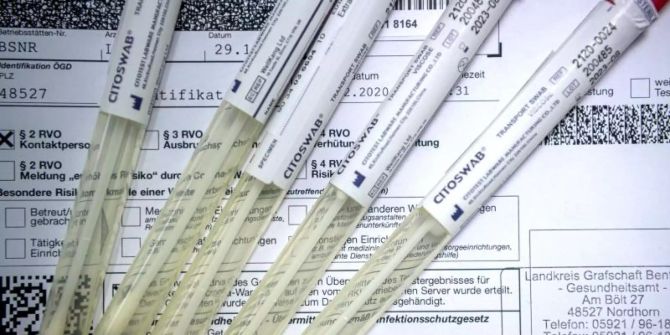 PCR-Test Coronavirus