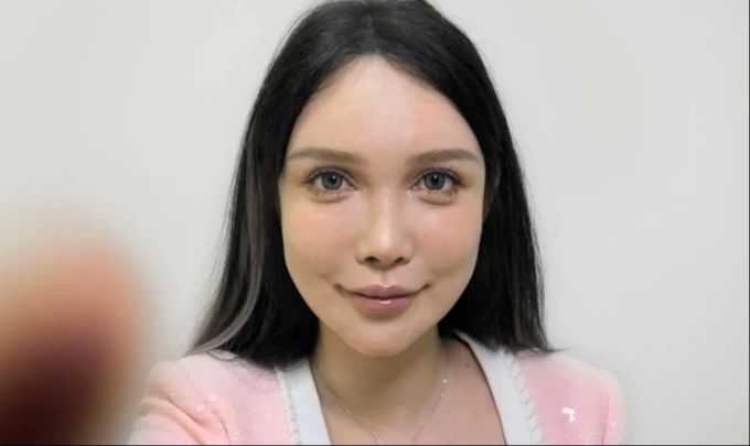 Abby Wu findet ständig etwas, um sich erneut unters Messer zu legen. Abby Wu