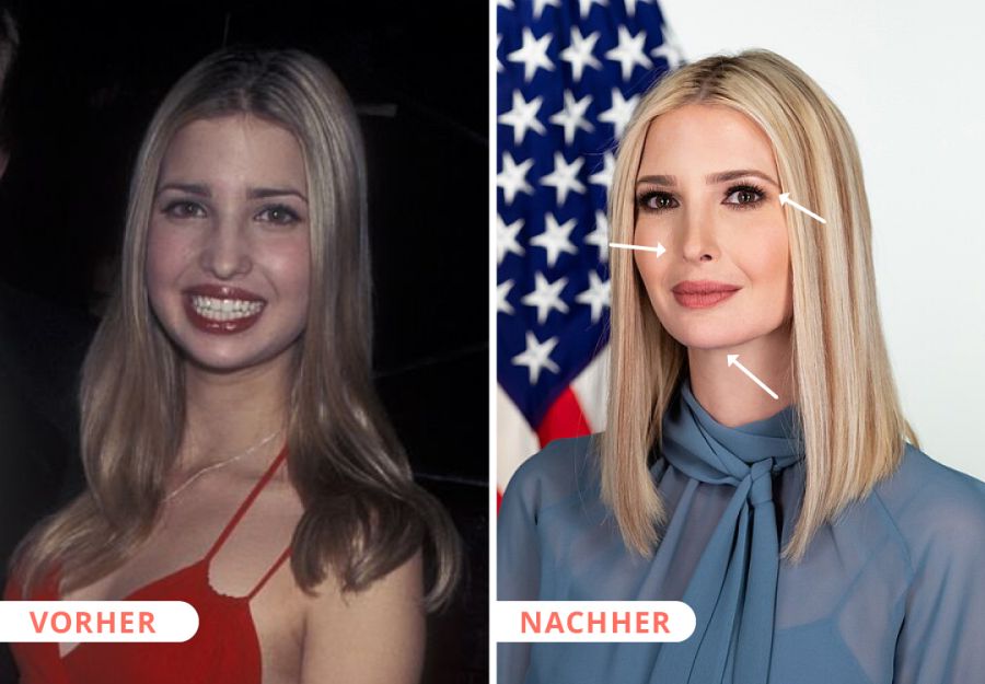 Ivanka Trump
