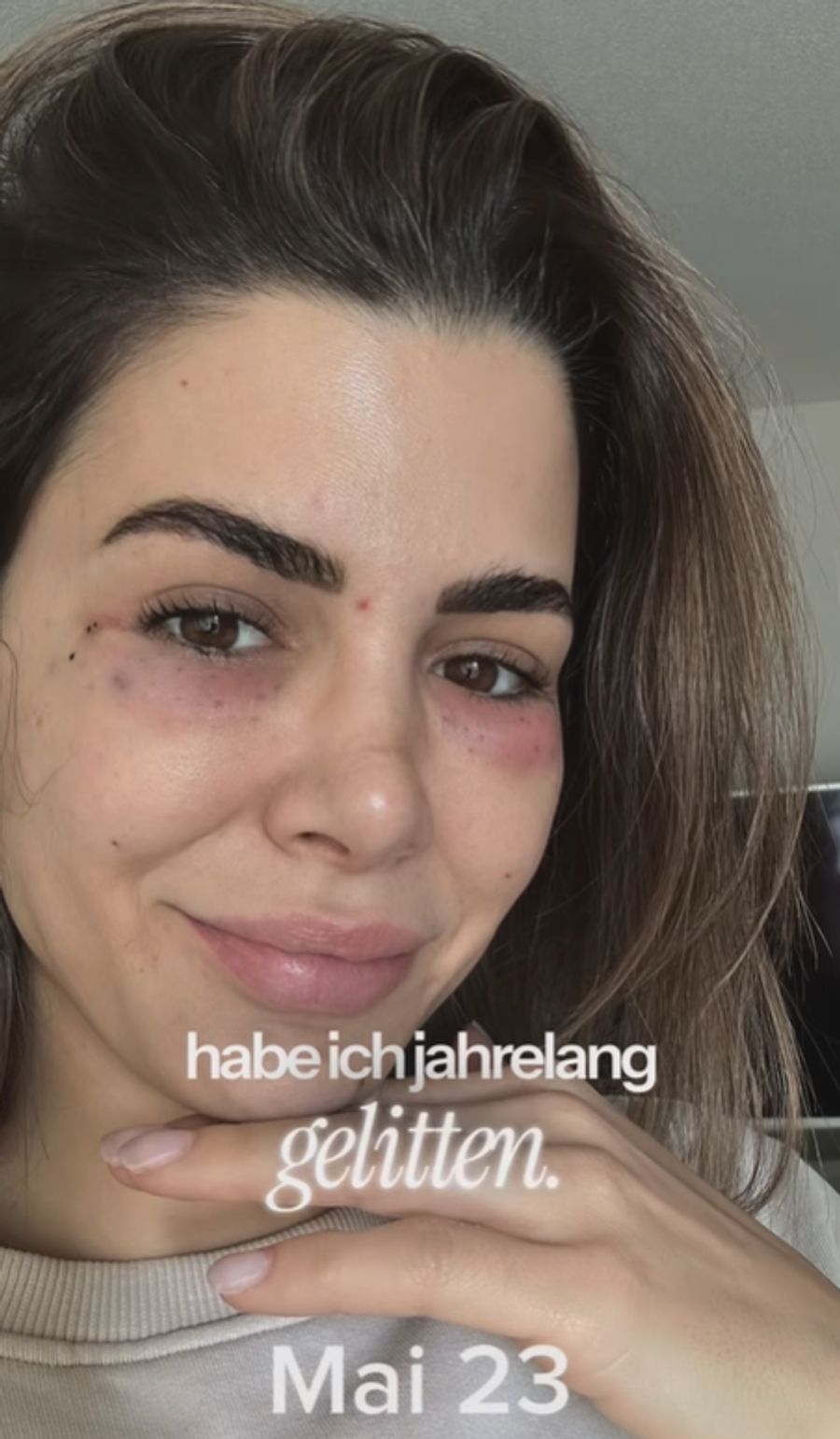 Andrina Santoro wollte eigentlich nur etwas frischer aussehen.