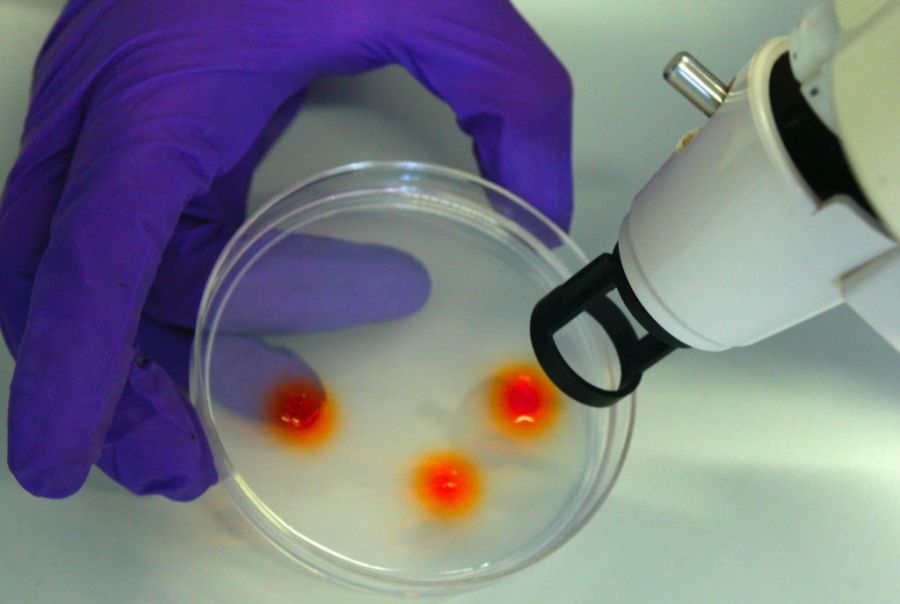 Das Spital hofft nach der Studie auf eine Zulassung der Behandlung. (Symbolbild)