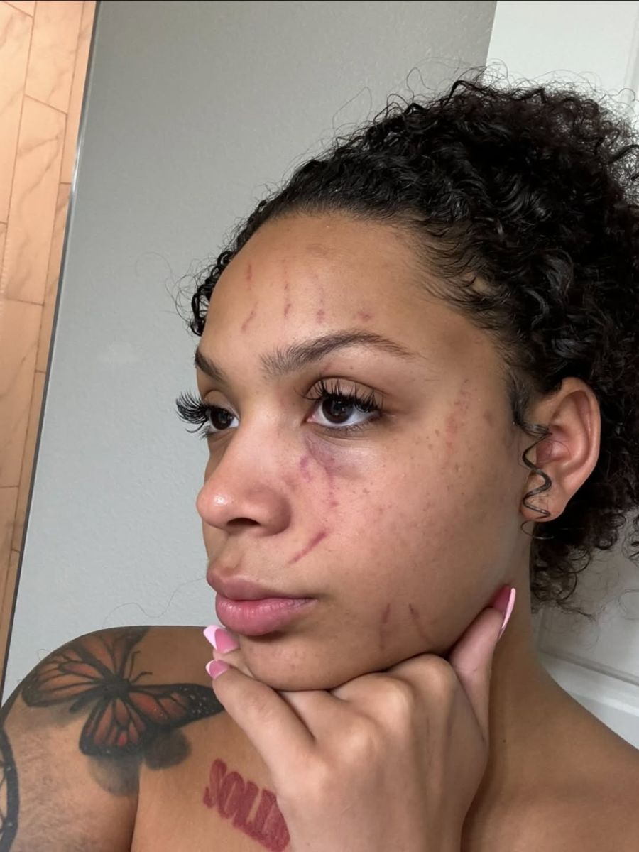 Sie wirft ihrem Ex-Freund häusliche Gewalt vor.