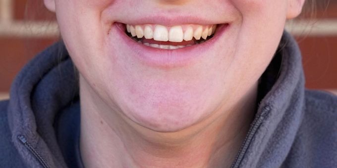 Stanford - Auch unechtes Lächeln macht Menschen ein wenig glücklicher