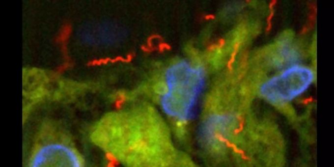 Beobachtungen eines Mediziners zufolge sind sexuelle Erkrankungen während der Corona-Pandemie insgesamt weniger geworden, die Zahl der Syphilis-Infektionen stieg jedoch an. Foto: PD Dr. Annette Moter/Charite-Universitätsmedizin Berlin/dpa Beobachtungen eines Mediziners zufolge sind sexuelle Erkrankungen während der Corona-Pandemie insgesamt weniger geworden, die Zahl der Syphilis-Infektionen stieg jedoch an. Foto: PD Dr. Annette Moter/Charite-Universitätsmedizin Berlin/dpa