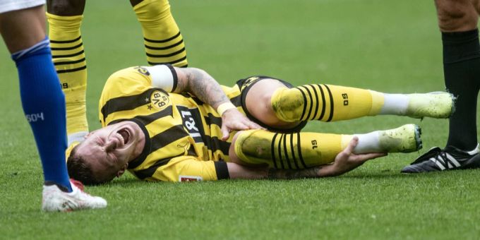 «WM nicht gefährdet» - BVB-Sportchef gibt nach Reus-Ausfall Entwarnung