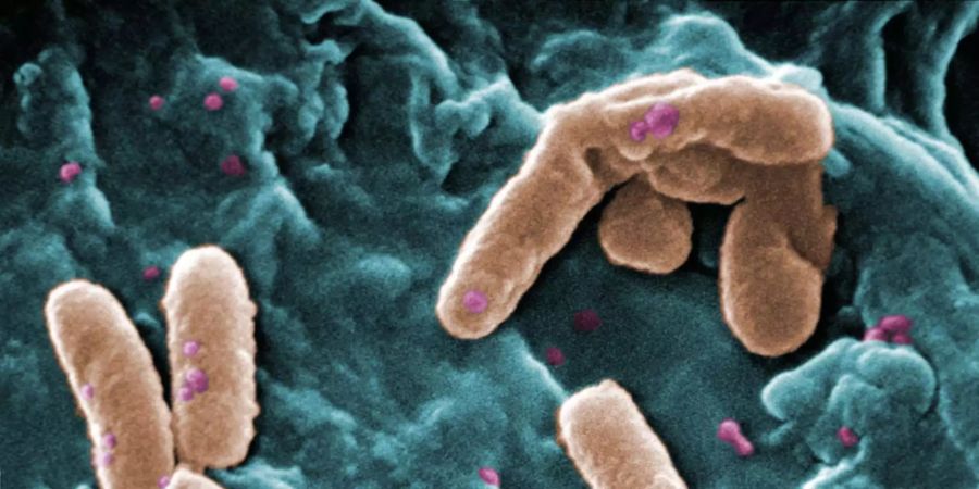 Der Spitalkeim Pseudomonas aeruginosa kann tödlich wirken.