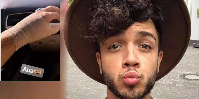 Fans in Sorge - Luca Hänni erklärt seine Daumen-Verletzung