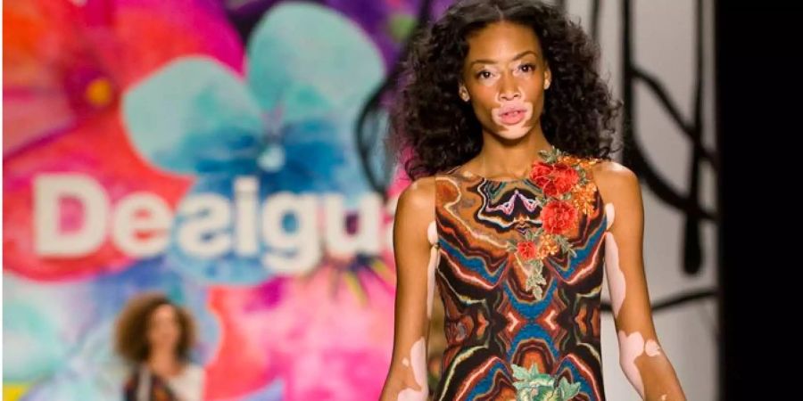 Das kanadische Model Winnie Harlow präsentiert 2015 eine Kreation der Herbst-Kollektion von Desigual während der Mercedes-Benz Fashion Week in New York.