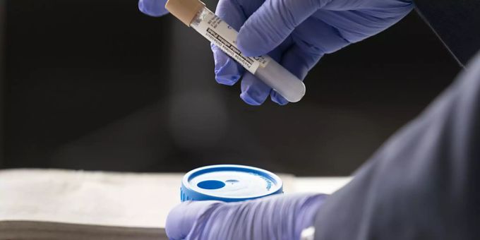 Die zuständige Nationalratskommission verlangt vom Bundesrat, dass die Tests gratis bleiben. (Symbolbild) Corona Test gratis