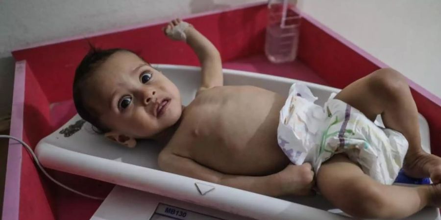 Eine Krankenschwester ermittelt das Gewicht eines unterernährten Kindes im Ibn Sina Krankenhaus in Idlib. Das Welternährungsprogramm (WFP) geht von 270 Millionen Menschen aus, die in 2021 akut an Hunger leiden oder davon stark gefährdet sein werden. Foto: Anas Alkharboutli/dpa