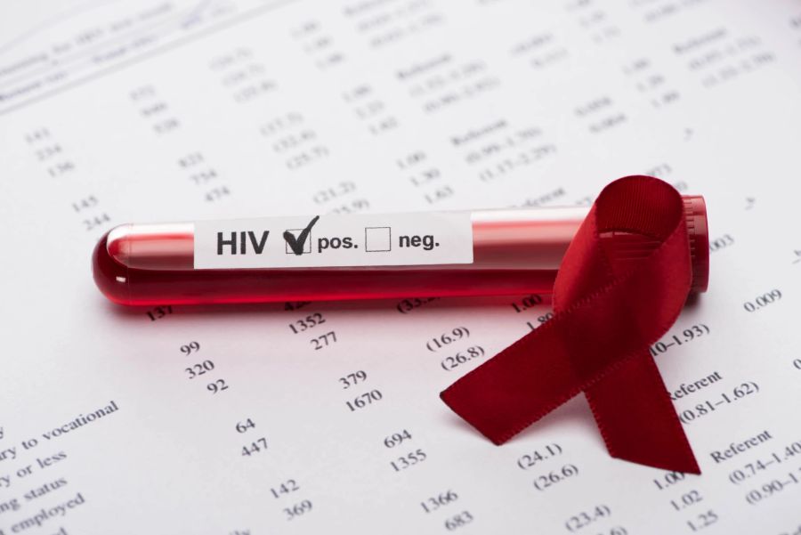 hiv Antikörper
