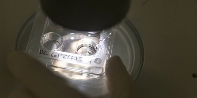 Eizellen/Embryonen in einer Kulturschale am Stereomikroskop, an der Abteilung für Reproduktionsmedizin des Inselspital Bern, am 12. Mai 2015. Eizellen Embryonen Inselspital