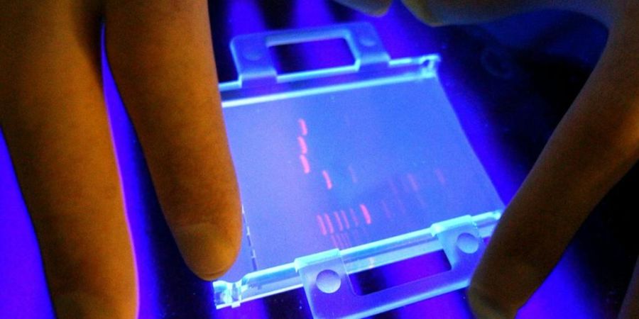 Das Aargauer Obergericht pfeift die Staatsanwaltschaft zurück: Ein geständiger Kiosk-Räuber muss kein zweites DNA-Profil abgeben. (Symbolbild)
