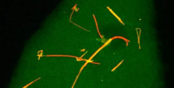 Röntgenaufnahme einer Zelle, die besagten Nanoröhrchen ausgesetzt worden ist. Asbest Handy