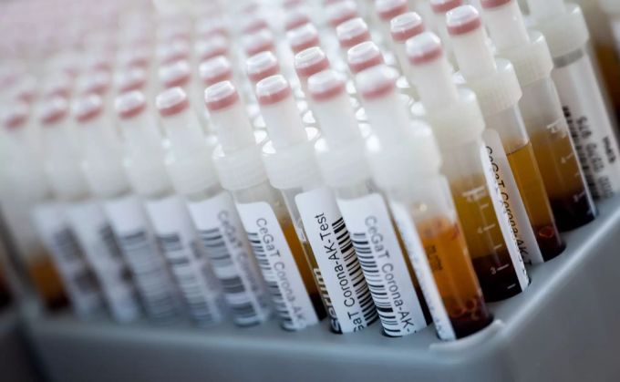 Blutentnahmeröhrchen mit Blutproben für einen Corona-Antikörper-Test stehen in einem Rack. Antikörper Test Coronavirus