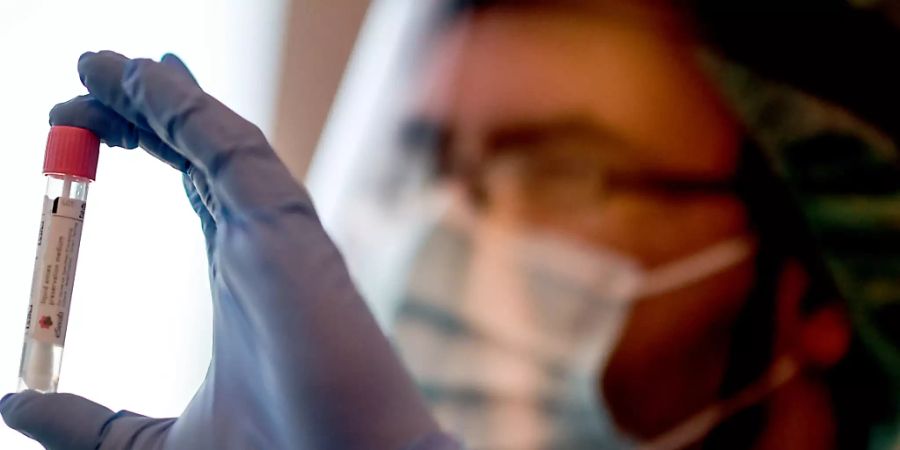 Ein Arzt hält in der Corona-Teststelle am Flughafen Schönefeld einen Abstrich für einen Coronavirus-Test. Foto: Britta Pedersen/dpa-Zentralbild/dpa