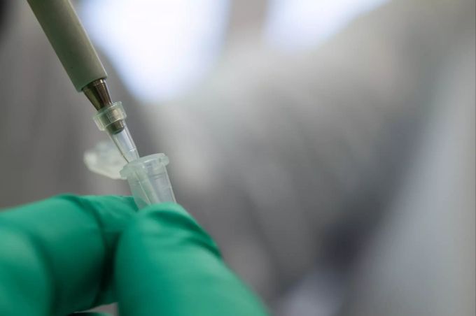 Mutationen des tödlichen Coronavirus breiten sich rund um den Globus aus. Die Folge: steigende Zahlen, strengere Massnahmen. corona