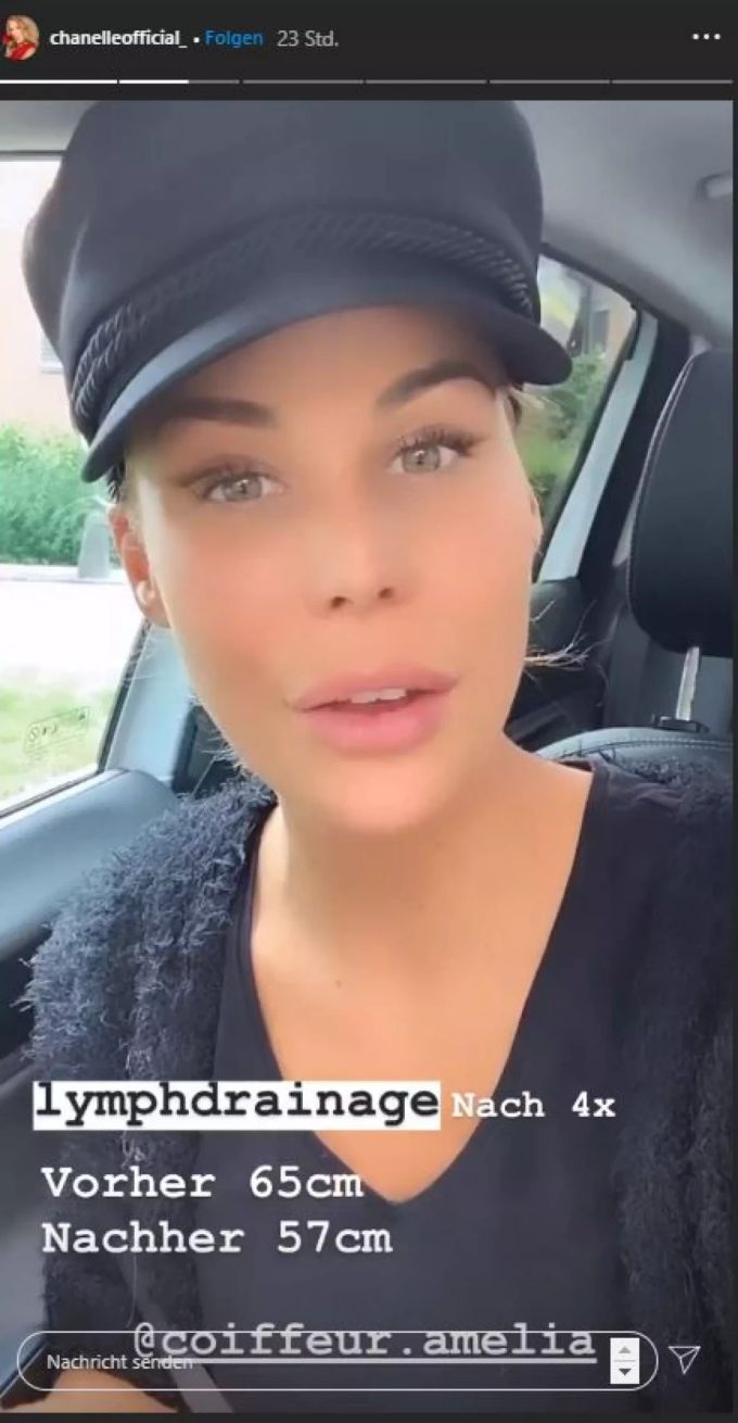 Bachelorette Chanelle schwärmt von den Behandlungen. chanelle