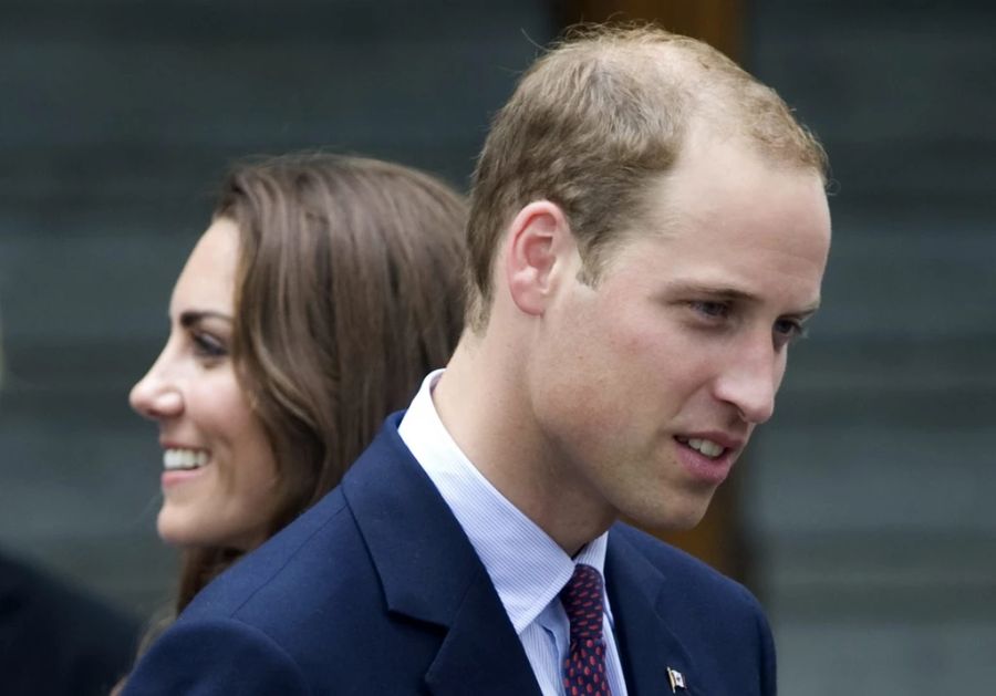 Prinz William verlor seine Haare schon in jungem Alter.