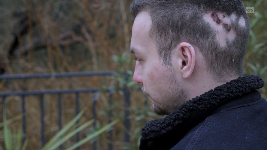 An seinem Hinterkopf fehlen ihm Haare.