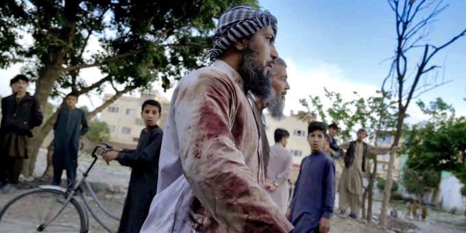 Ein Moscheebesucher nach der Explosion in Kabul, bei der mindestens 20 Personen verletzt oder getötet wurden. afghanistan