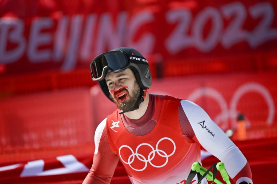 Daniel Hemetsberger kommt mit einer blutigen Nase im Ziel an.