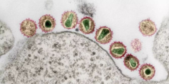 HIV antikörper