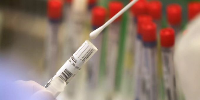 Covid plus Grippe - Deshalb hat die Schweiz noch keinen Kombi-Test