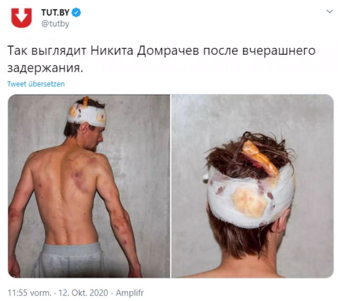 Nikita Domratschaw stellt diese Bilder online. Biathlon