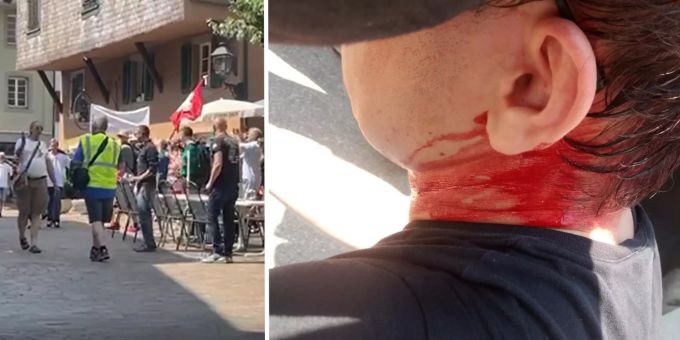 Coronavirus: Das Opfer der Flaschen-Attacke von Olten SO zog sich eine Platzwunde am Kopf zu. Demo Olten Coronavirus Opfer