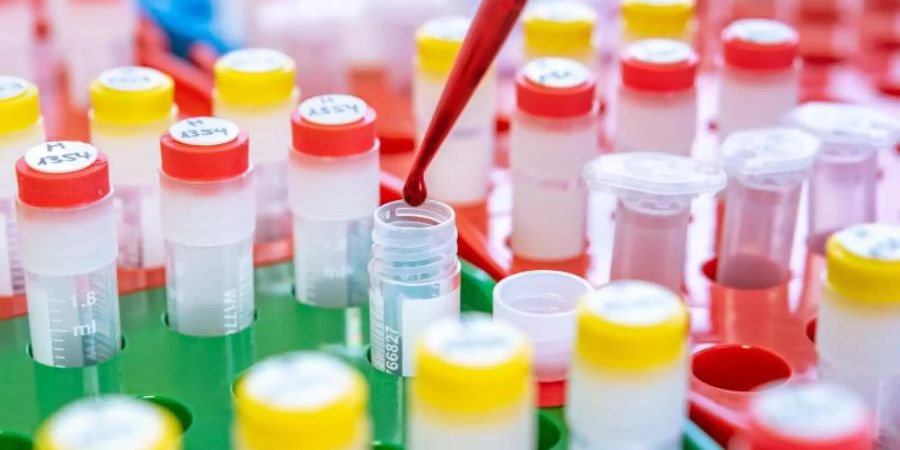 Drei Tage vor der PR-Aktion hatte die Pressesprecherin des Klinikums den Vorstand gewarnt. Foto: Labor/Universitätsklinikum Heidelberg