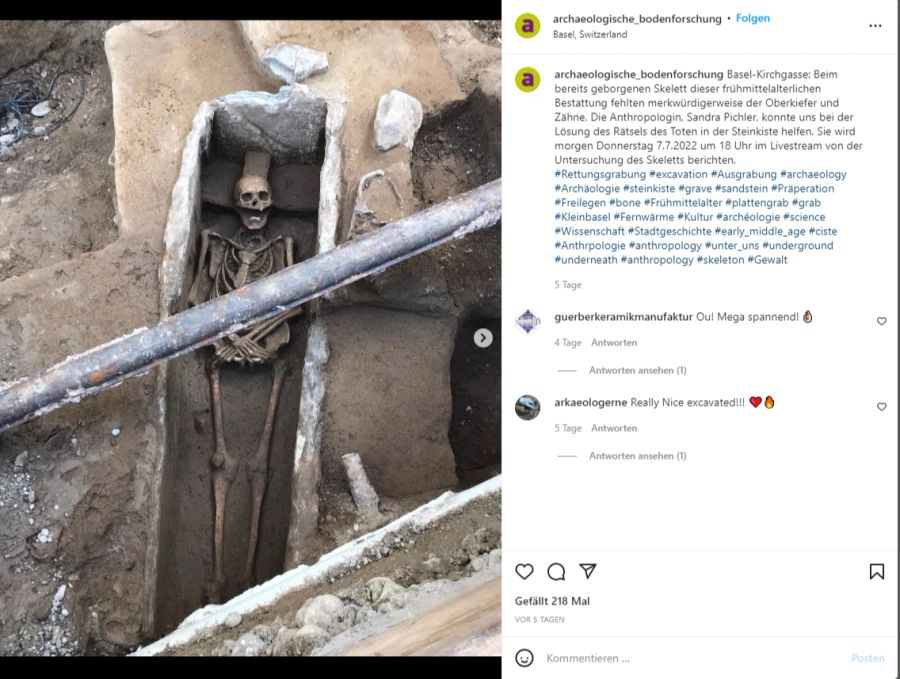 Bitte lächeln! Diesem Skelett wurde zu Lebzeiten der Oberkiefer mit einem Schwerthieb entfernt.