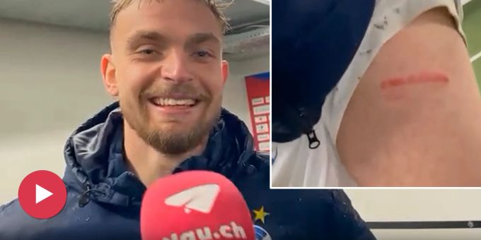Rot-Tritt - GC-Fink zeigt Xhaka-Narben: «Er traf mich im Intim-Bereich»