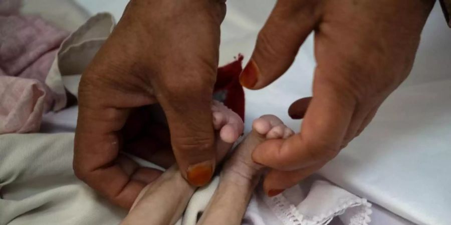 Unternährtes Kind: Die Zahl der an Hunger leidenden Minderjährigen in Afghanistan ist massiv gestiegen. Foto: Bram Janssen/AP/dpa