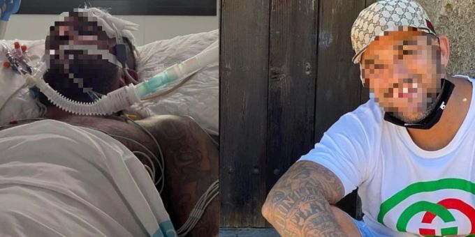 Diese auf der Website «justicefortoby.com» veröffentlichten Bilder zeigen den Familienvater Tobias White-Sansom vor und nach dem Vorfall auf Mallorca. tobais white-sansom