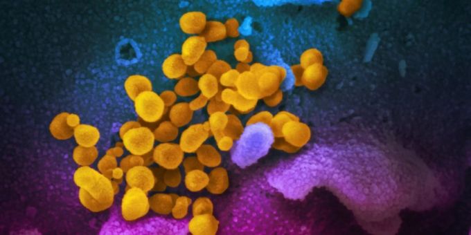 Coronaviren (gelb) unter dem Rasterelektronenmikroskop Coronavirus