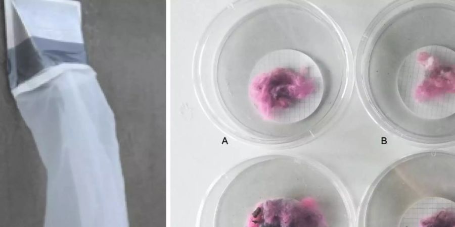 Das undatierte Bild zeigt einen Entlüftungsbeutel (l) und Fasern. Elektrische Wäschetrockner geben mehrere Tausend Mikrofasern in die Umgebung ab. Foto: Rachael Z. Miller/Plos One/dpa