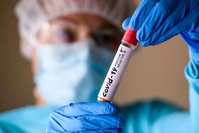 Laut BND kommt das Coronavirus aus einem chinesischen Labor. coronavirus bnd