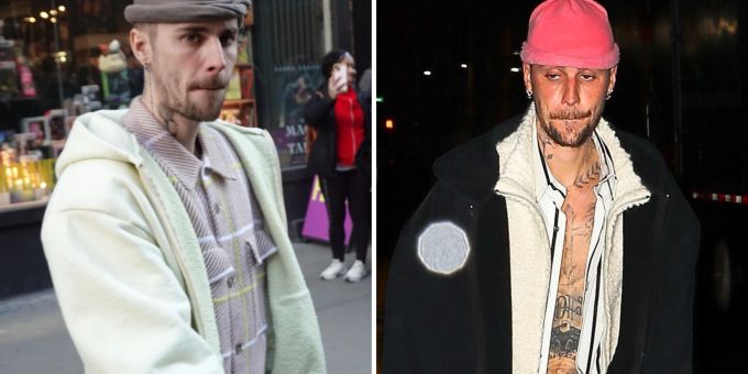 «Druck, Angst» - Darum beisst sich Justin Bieber immer auf die Lippen