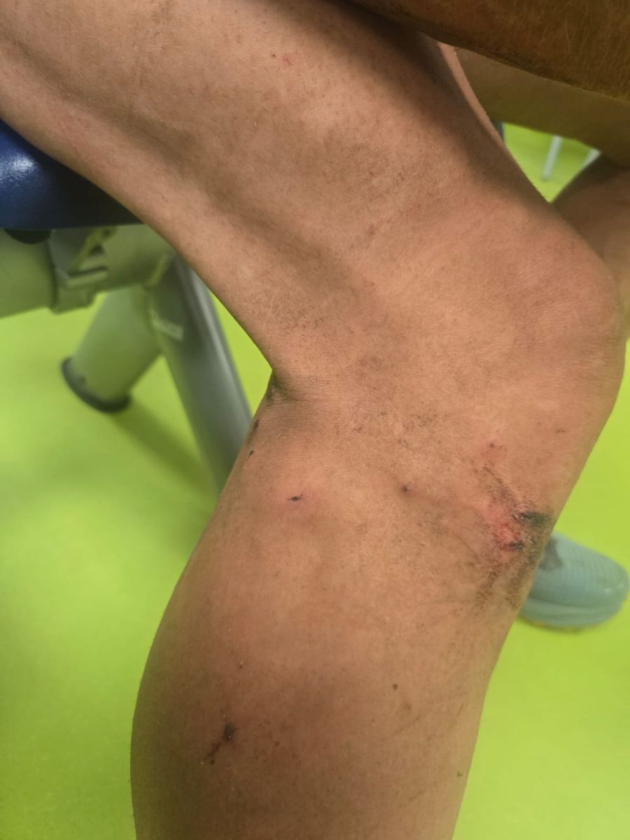 Trotzdem wurde er von drei Herdenschutzhunden angegriffen und mehrfach gebissen – er hinkt noch immer.