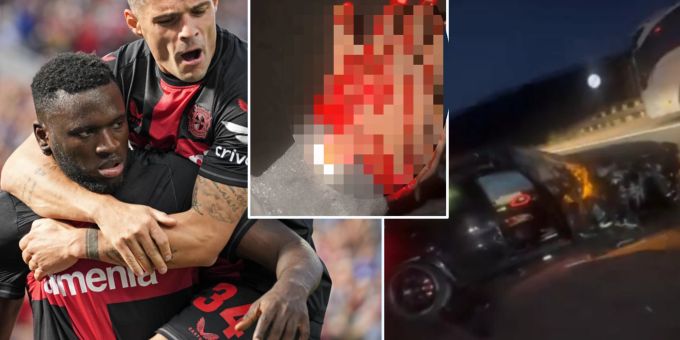 Blutige Hände - Xhaka-Teamkollege crasht nach Bundesliga-Spiel heftig